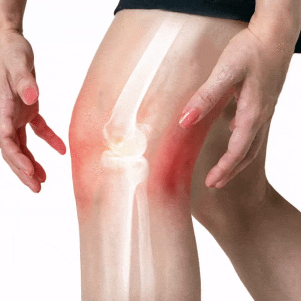 PainAway Knee Massager For Arthritis Treatment & Pain Relief